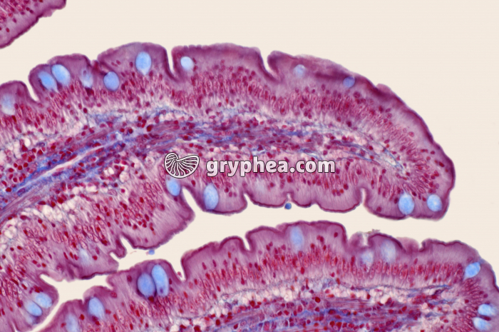 Duodenum x100 - gryphea.org